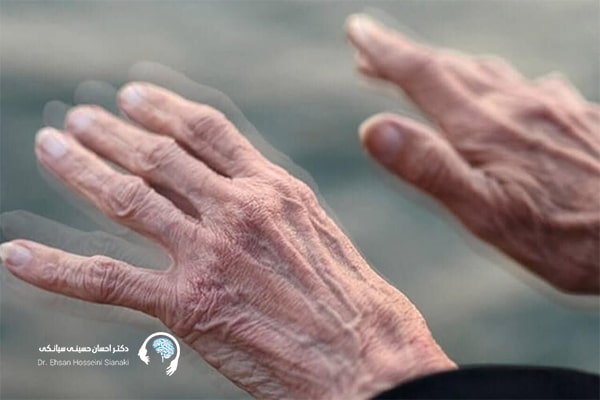 اهداف گفتاردرمانی در بیماران پارکینسونی