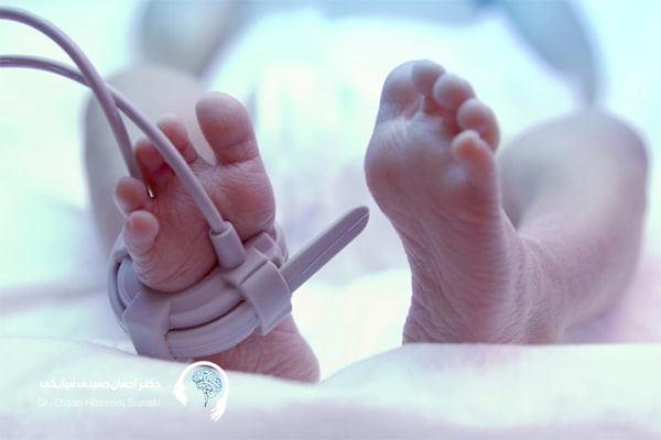 تاثیر نوروفیدبک بر هوش نوزادان نارس